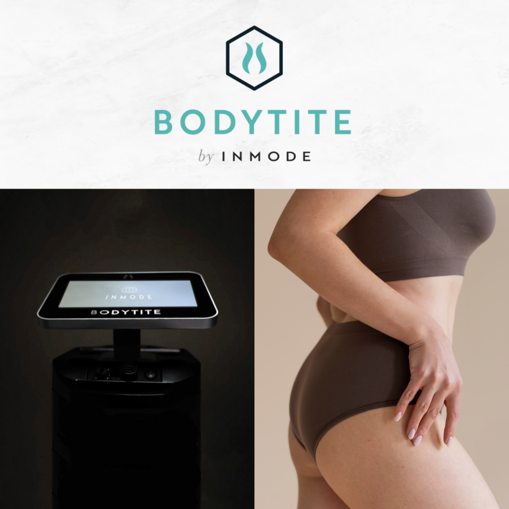 BodyTite in combinatie met liposuctie