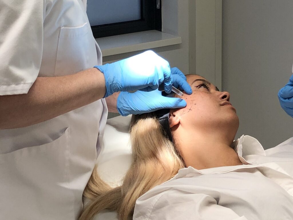 arts injecteert filler in jukbeen van cliënte