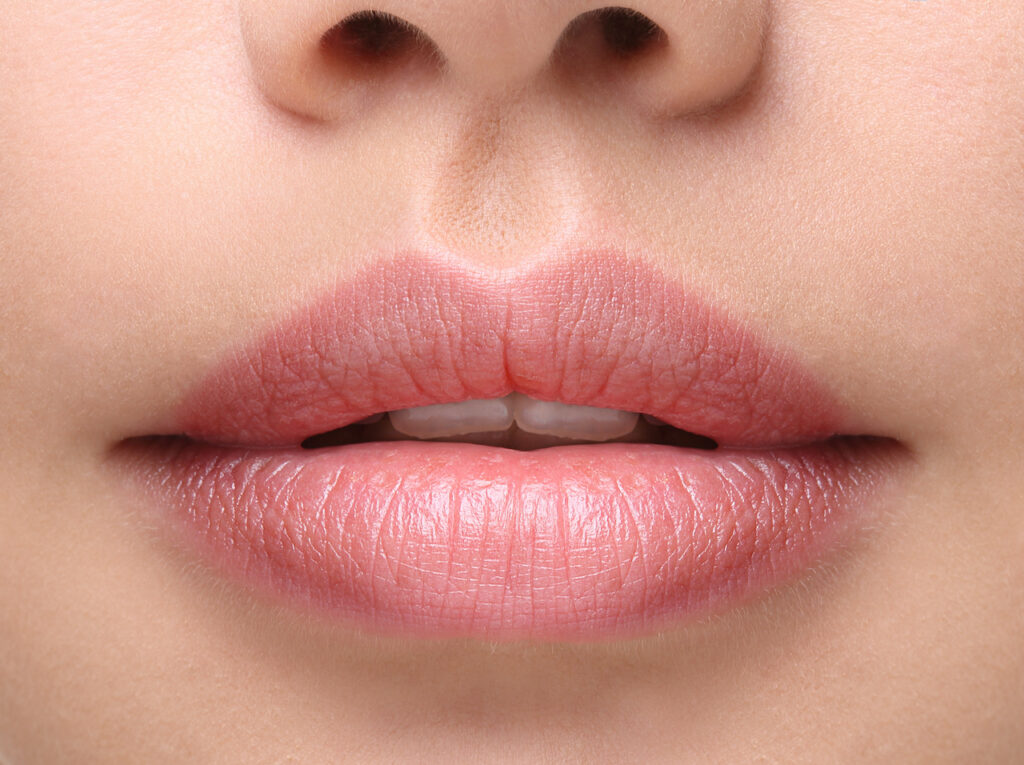 lipvergroting
