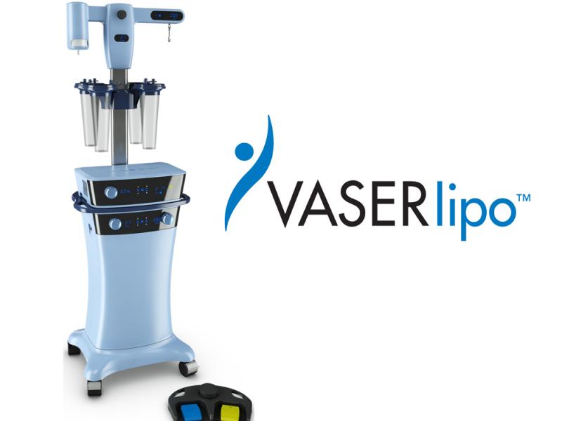 VASER apparaat voor ultrasone liposuctie en lichaamscontouring